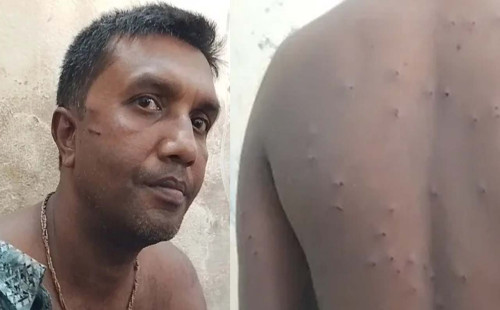 চোরাইপথে দেশে ফেরার সময় বিএসএফের গুলিতে যুবক আহত, যশোর হাসপাতালে ভর্তি